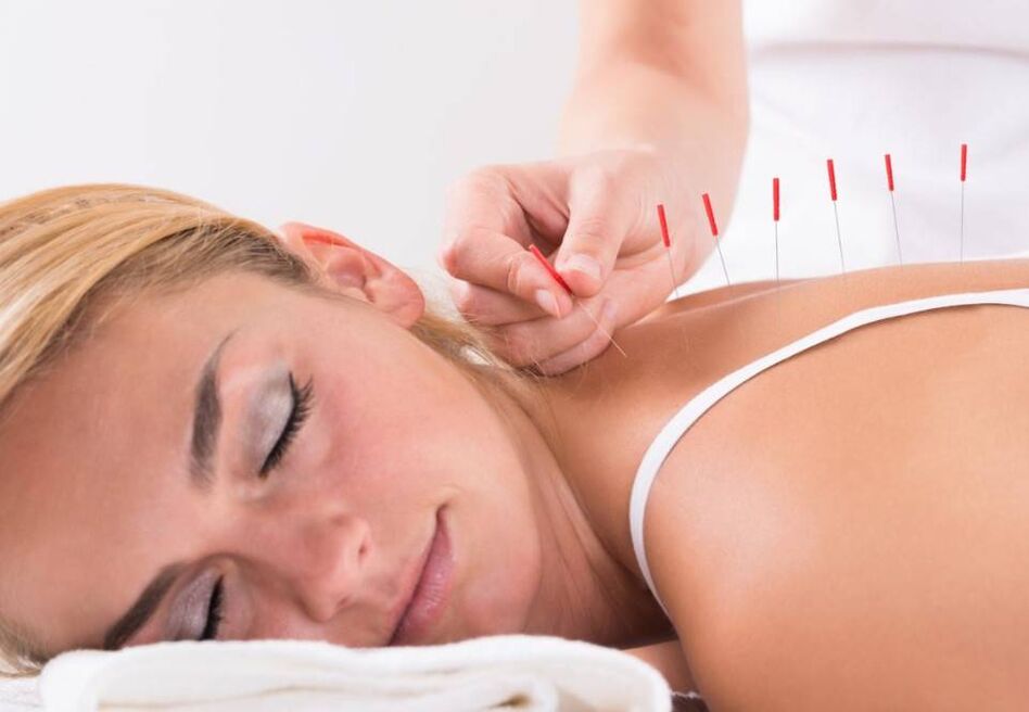 Akupunktura pomoże złagodzić ból w osteochondrozie